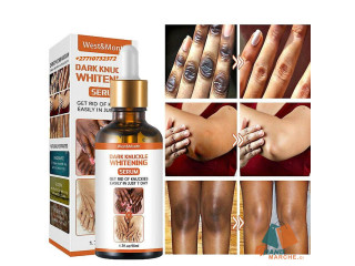 Dark Knuckle Elbow Knee Serum In Saldanha Town South Africa Call +2771 073 2372 Get Rid Of Scars And Stretch Marks In Nukus City in Uzbekistan